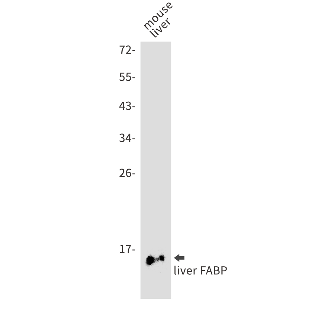 FABP1 Rabbit mAb