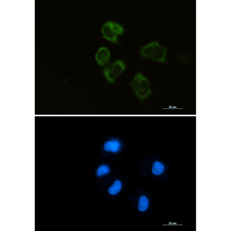 Lysozyme Rabbit mAb