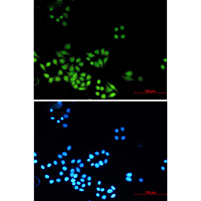 MAD2L2 Rabbit mAb