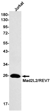 MAD2L2 Rabbit mAb