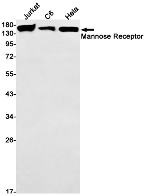 Mannose Receptor Rabbit mAb