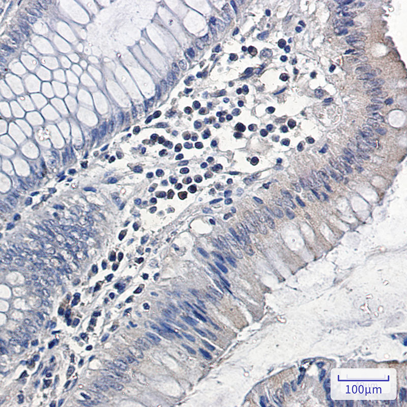 MAPK6 Rabbit mAb