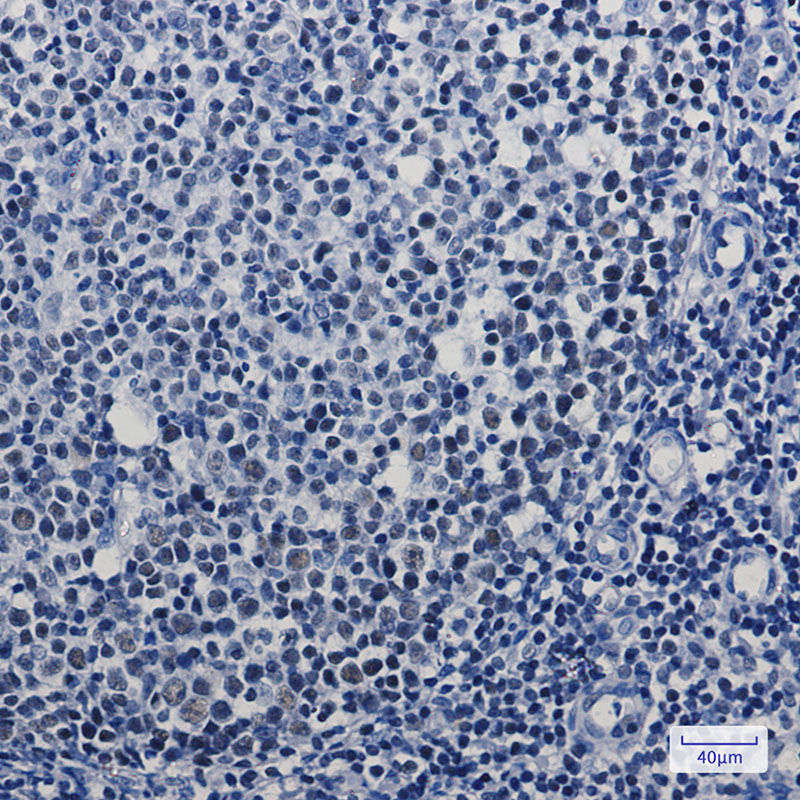 MBD2 Rabbit mAb