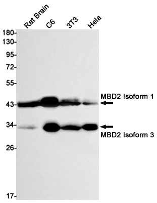 MBD2 Rabbit mAb