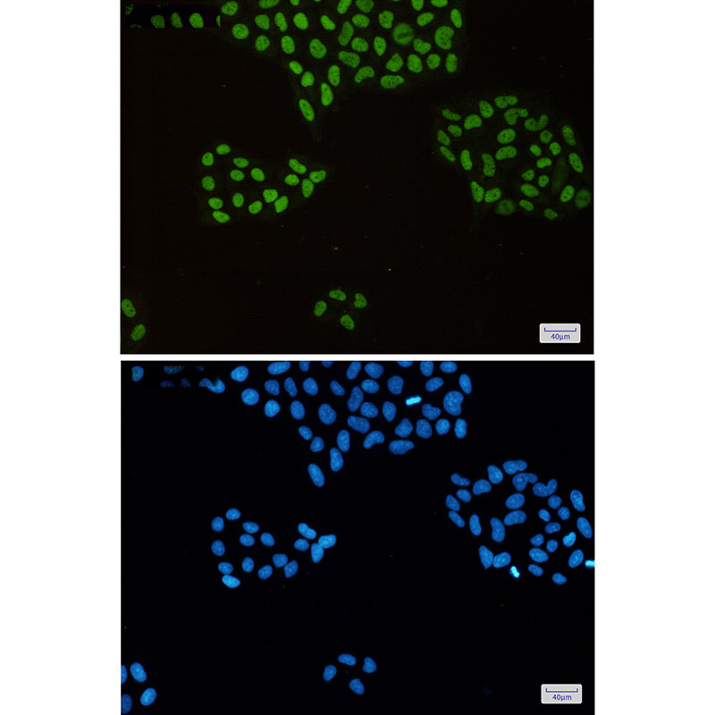 MCM2 Rabbit mAb