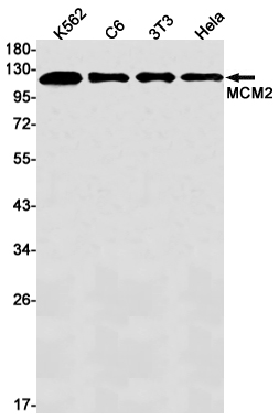 MCM2 Rabbit mAb