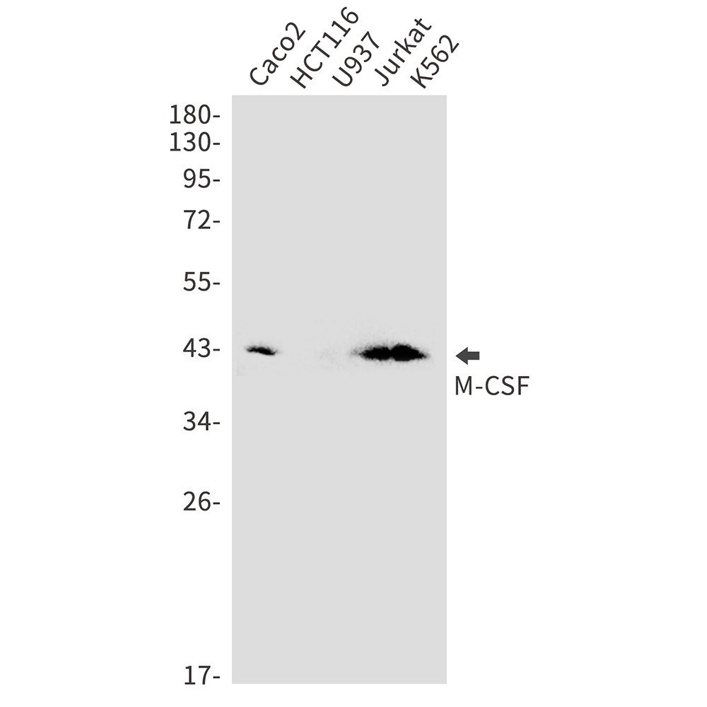 M-CSF Rabbit mAb