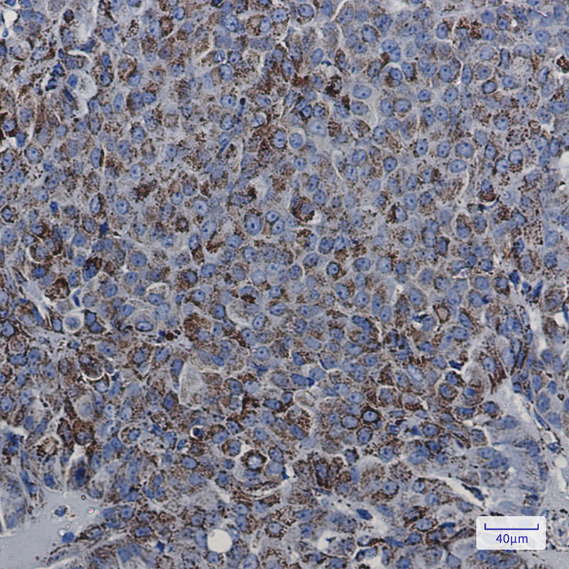 MDH2 Rabbit mAb