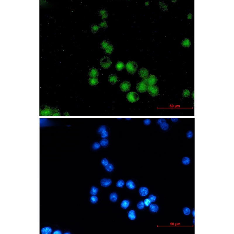 MEF2A Rabbit mAb