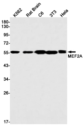 MEF2A Rabbit mAb