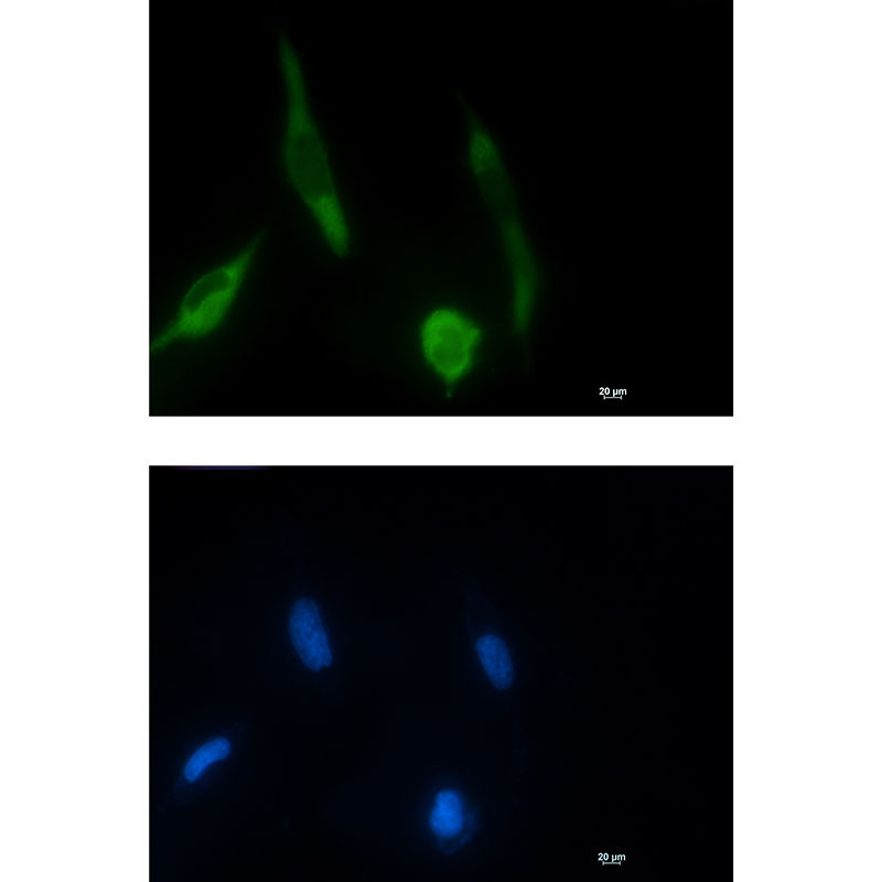 Phospho-MEK1 (Ser298) Rabbit mAb