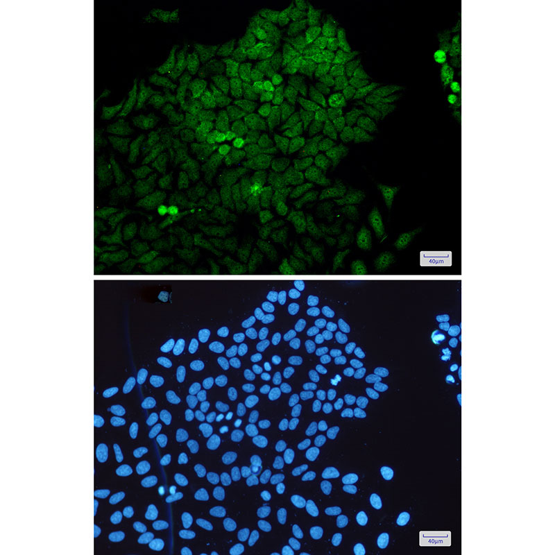 MEK3 Rabbit mAb