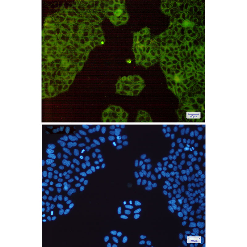 c-Met Rabbit mAb