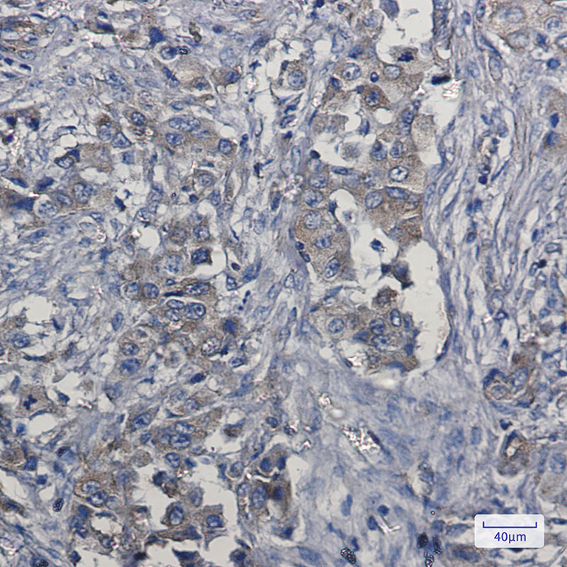 c-Met Rabbit mAb