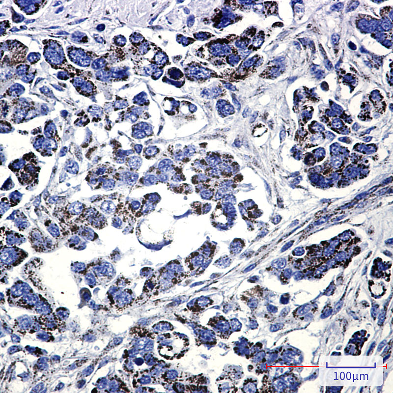 Methylmalonyl Coenzyme A mutase Rabbit mAb