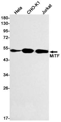 MiTF Rabbit mAb