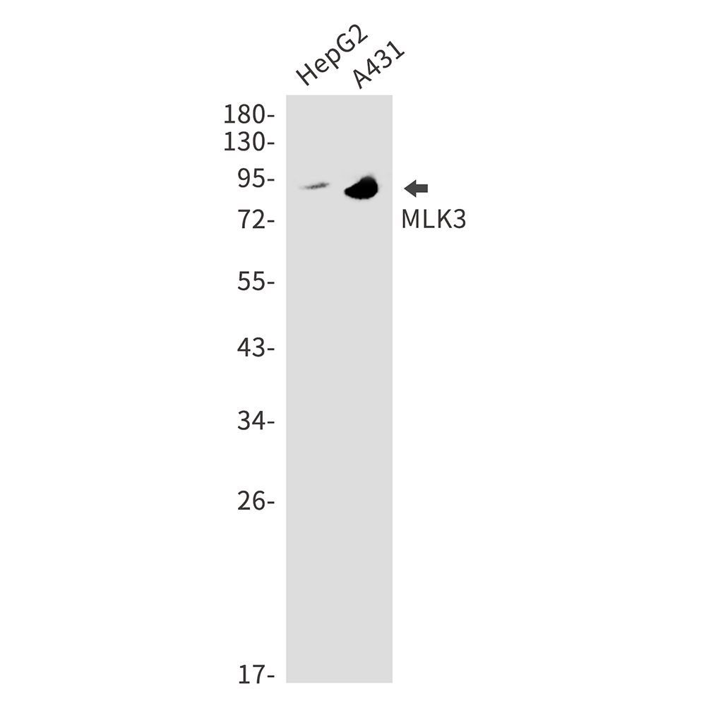 MLK3 Rabbit mAb