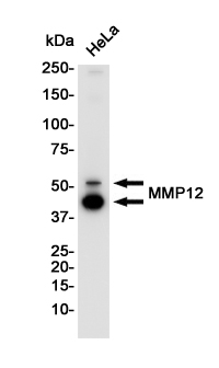 MMP12 Rabbit mAb