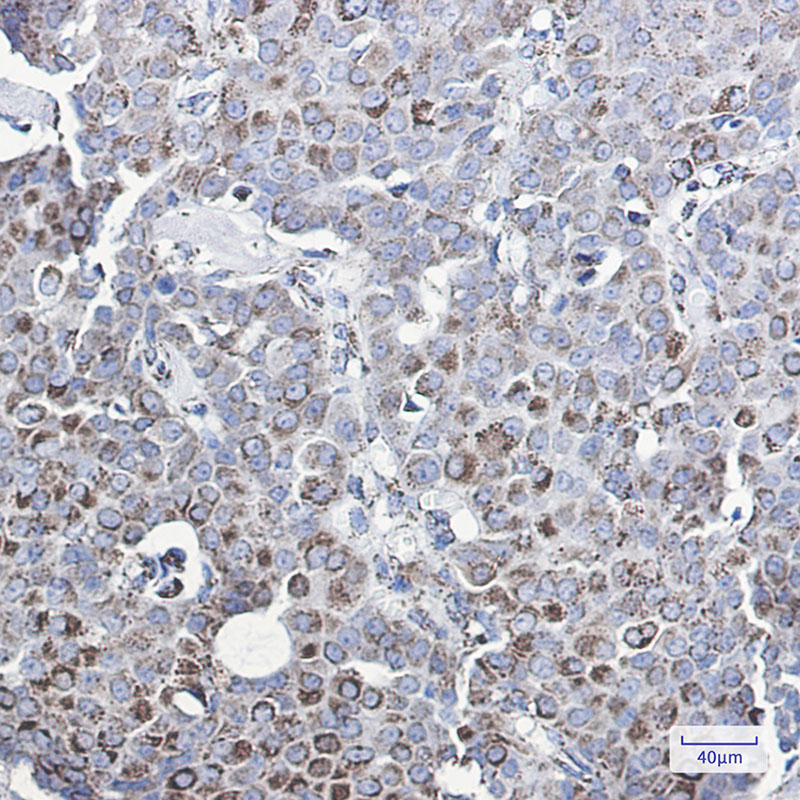 MMP3 Rabbit mAb