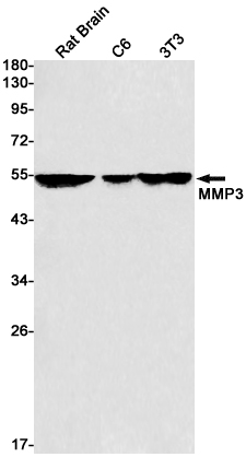 MMP3 Rabbit mAb