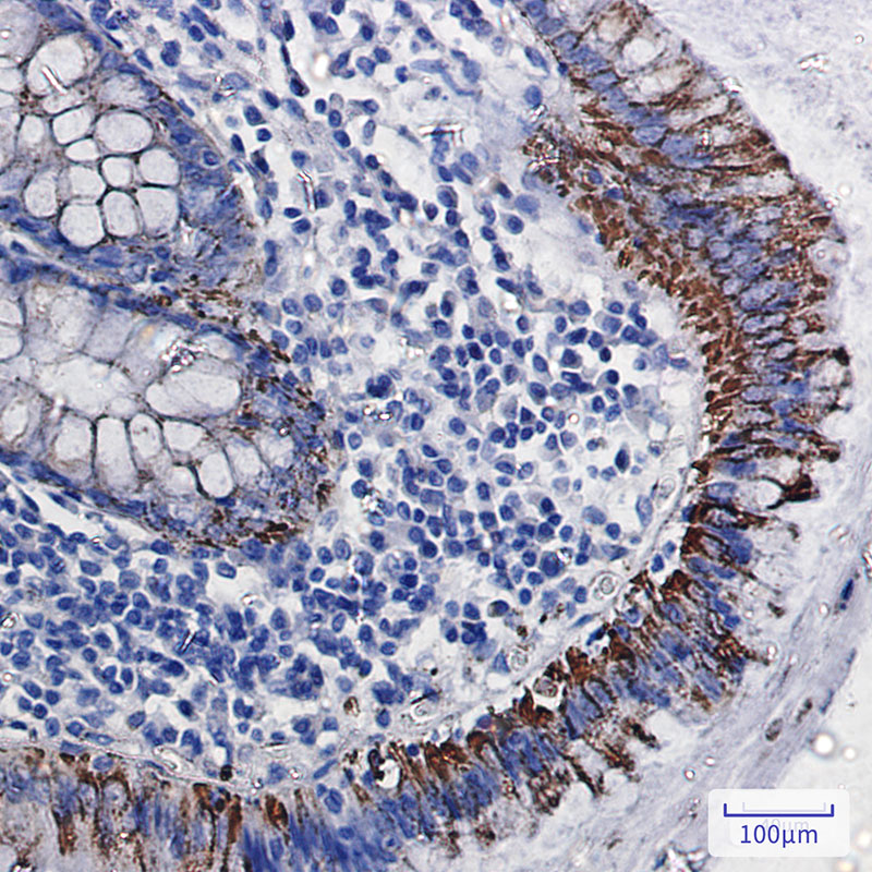 Monoamine Oxidase A Rabbit mAb