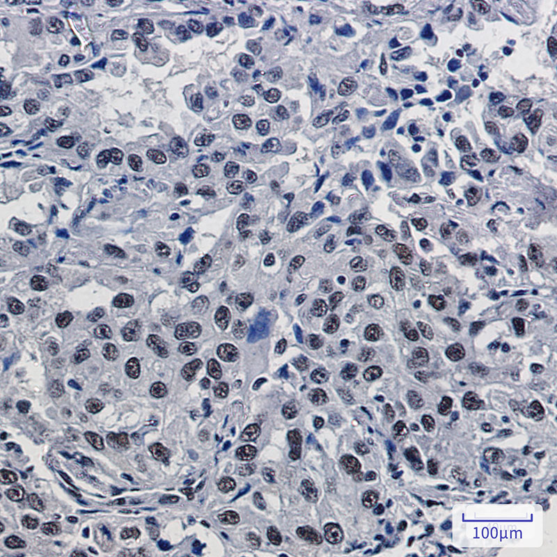 Mre11 Rabbit mAb