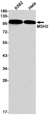 MSH2 Rabbit mAb