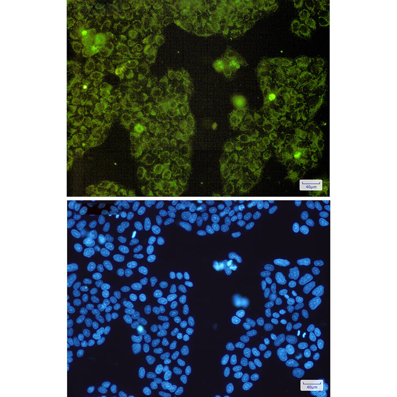 MTCO2 Rabbit mAb