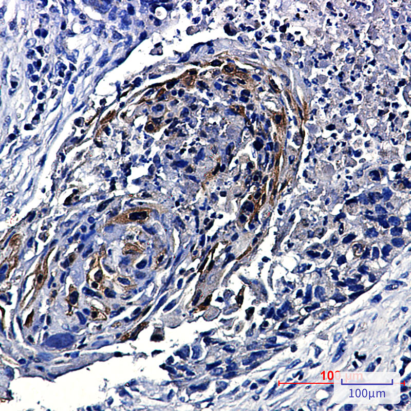 Phospho-mTOR (Ser2448) Rabbit mAb