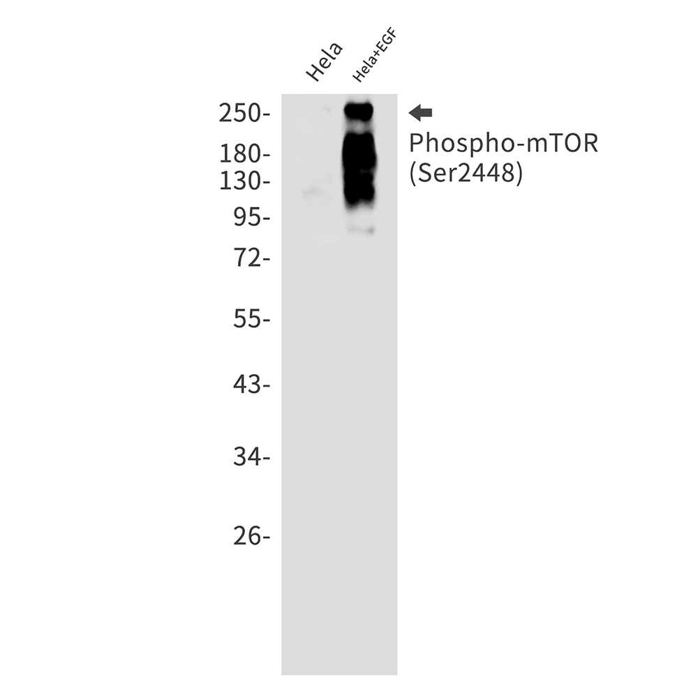 Phospho-mTOR (Ser2448) Rabbit mAb