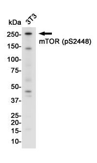 Phospho-mTOR (Ser2448) Rabbit mAb