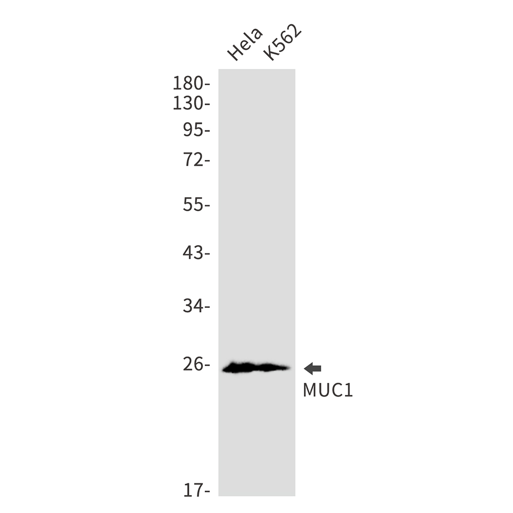 Mucin 1 Rabbit mAb