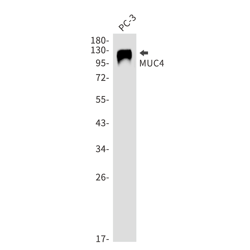 Mucin 4 Rabbit mAb