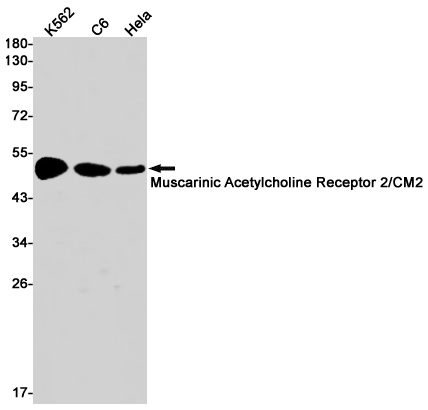 Muscarinic Acetylcholine Receptor M2 Rabbit mAb