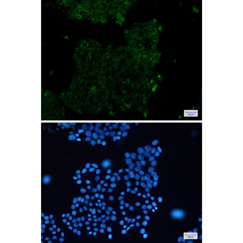 alpha Skeletal Muscle Actin Rabbit mAb