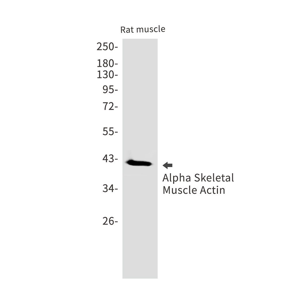 alpha Skeletal Muscle Actin Rabbit mAb