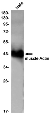 alpha Skeletal Muscle Actin Rabbit mAb