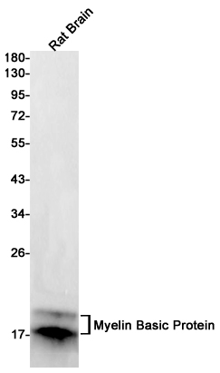 Myelin Basic Protein Rabbit mAb