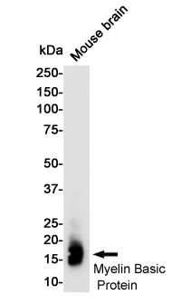 Myelin Basic Protein Rabbit mAb