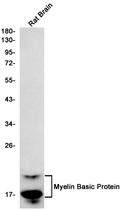 Myelin Basic Protein Rabbit mAb