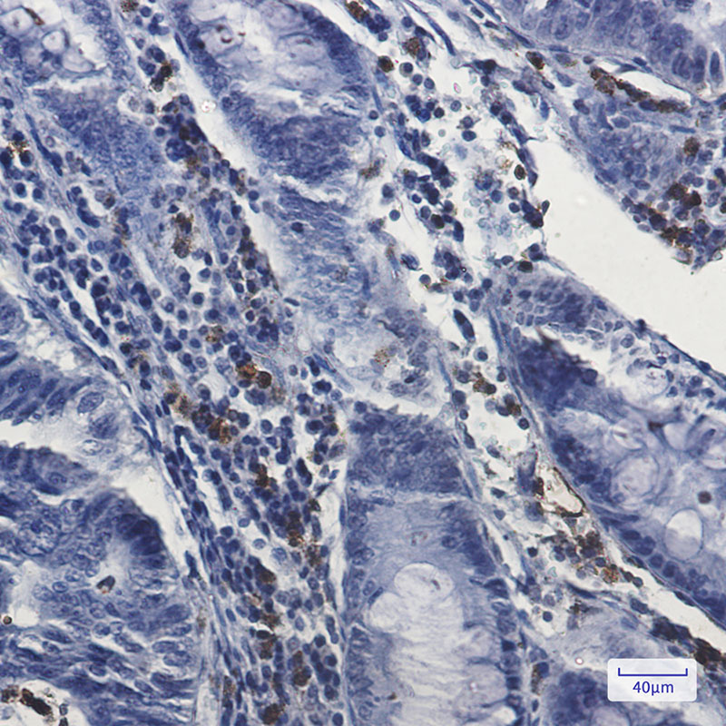 Myeloperoxidase Rabbit mAb