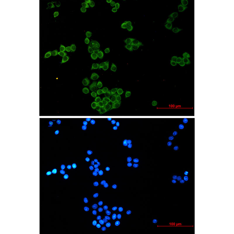 NCK1 Rabbit mAb