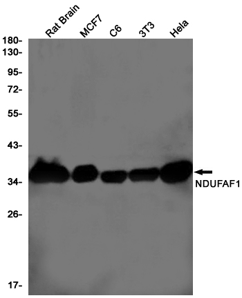 NDUFAF1 Rabbit mAb