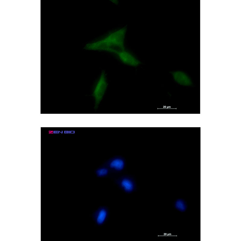 NDUFAF1 Rabbit mAb