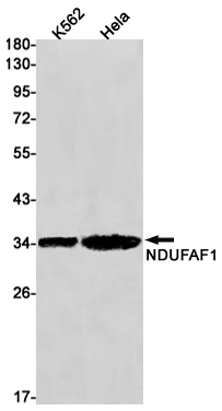 NDUFAF1 Rabbit mAb