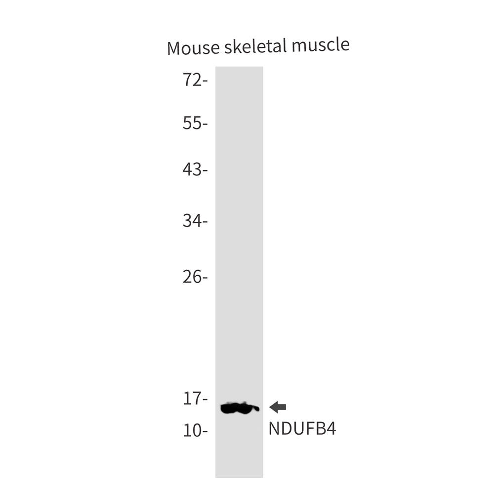 NDUFB4 Rabbit mAb