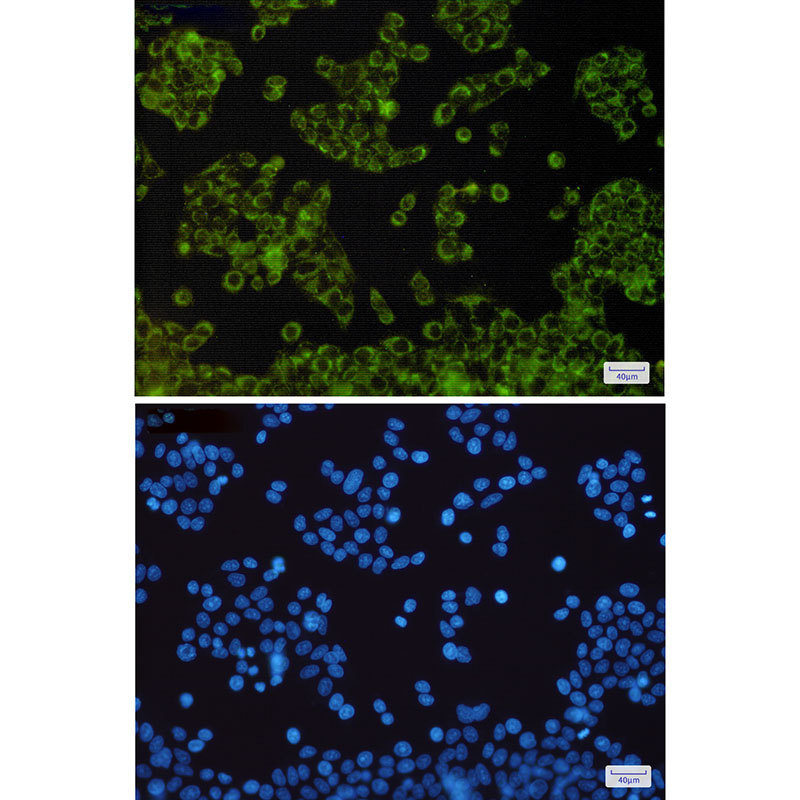 NDUFB9 Rabbit mAb