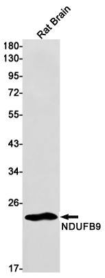 NDUFB9 Rabbit mAb