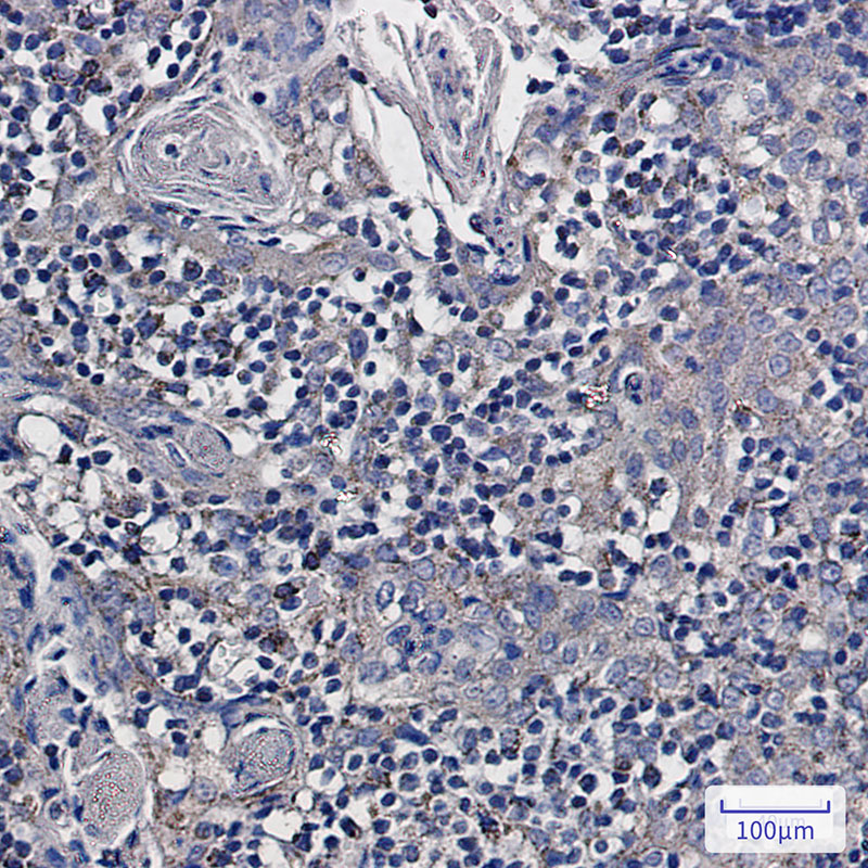 NDUFS6 Rabbit mAb