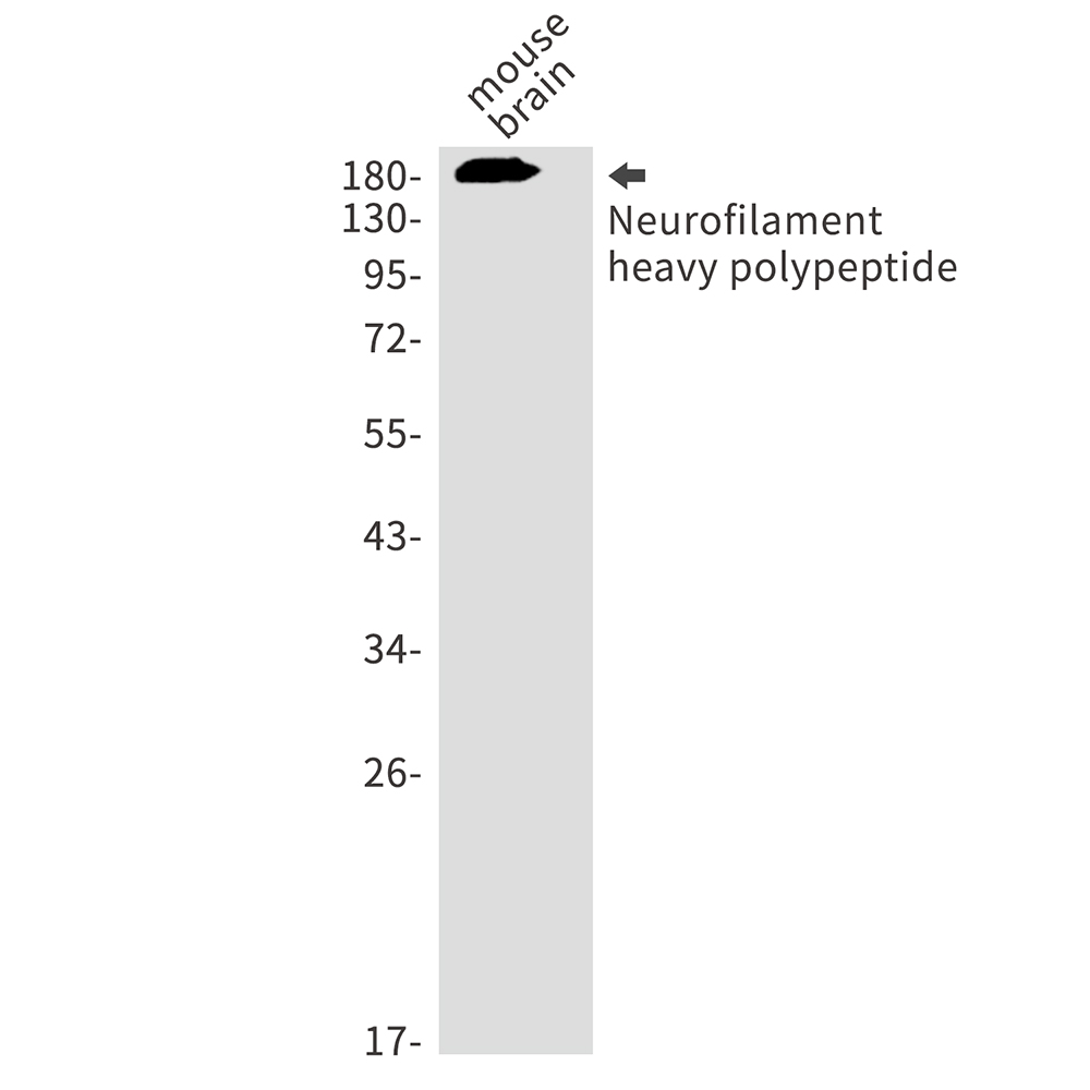 Neurofilament Heavy Polypeptide Rabbit mAb